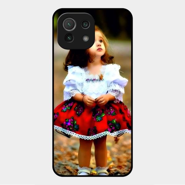 Doll Design Glossy Metal Case Cover For Xiaomi Mi 11 Lite